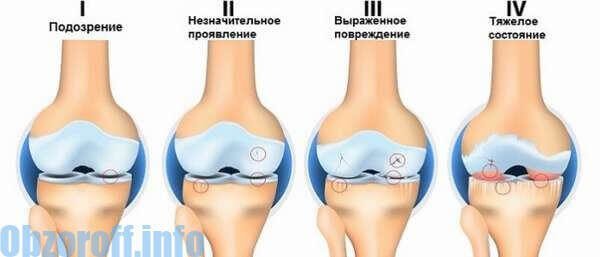 tratament pentru dureri de spate si picioare