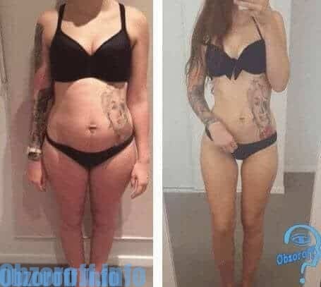 result Before and After Bifido Slim