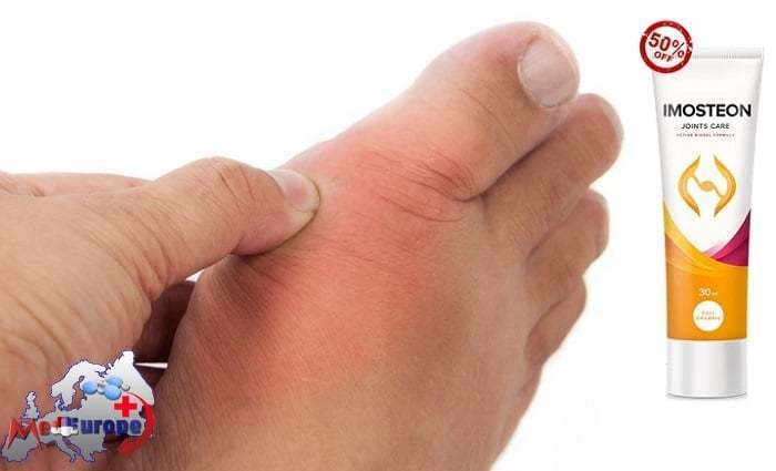 inflamația articulară pe unguentul piciorului