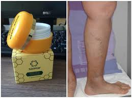 Cream Healthy from varicose veins and treatment of varicose veins