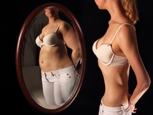 rasstroystva pischevogo povedeniya - Valgymo sutrikimai: anoreksija ir bulimija