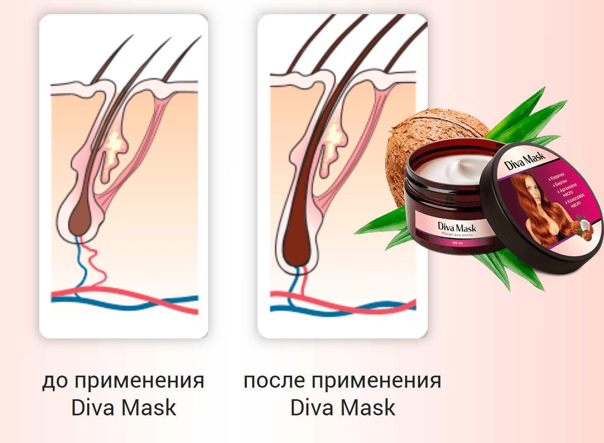 Operating principle Diva Mask