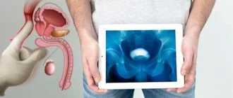 urologiya - Burning sensation in the urethra after urination: causes and treatment