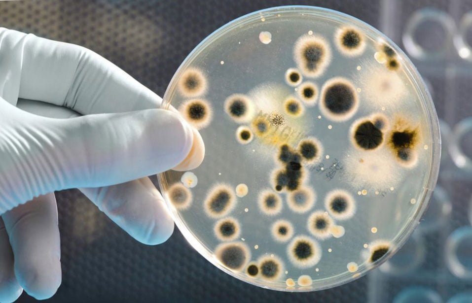 Wie entsteht die Harnstoffplasma-Krankheit?