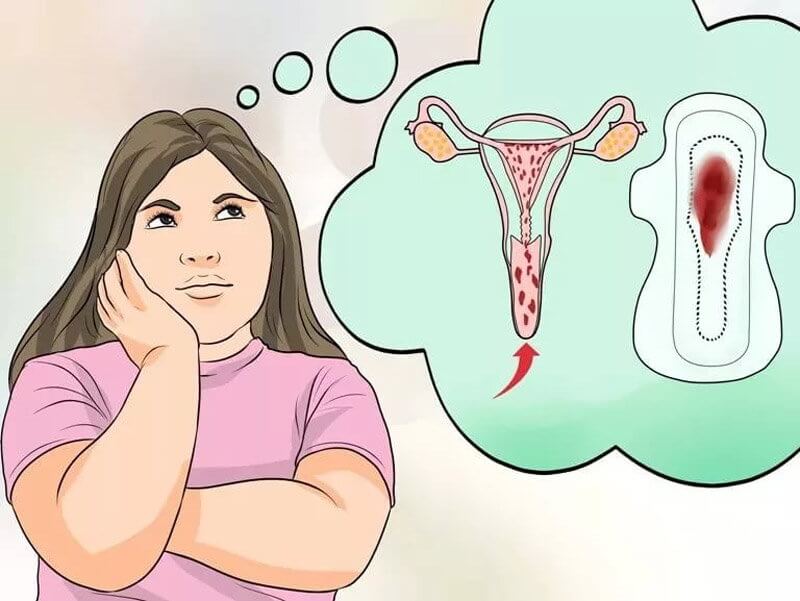 verursachen Menstruation während einer Verzögerung